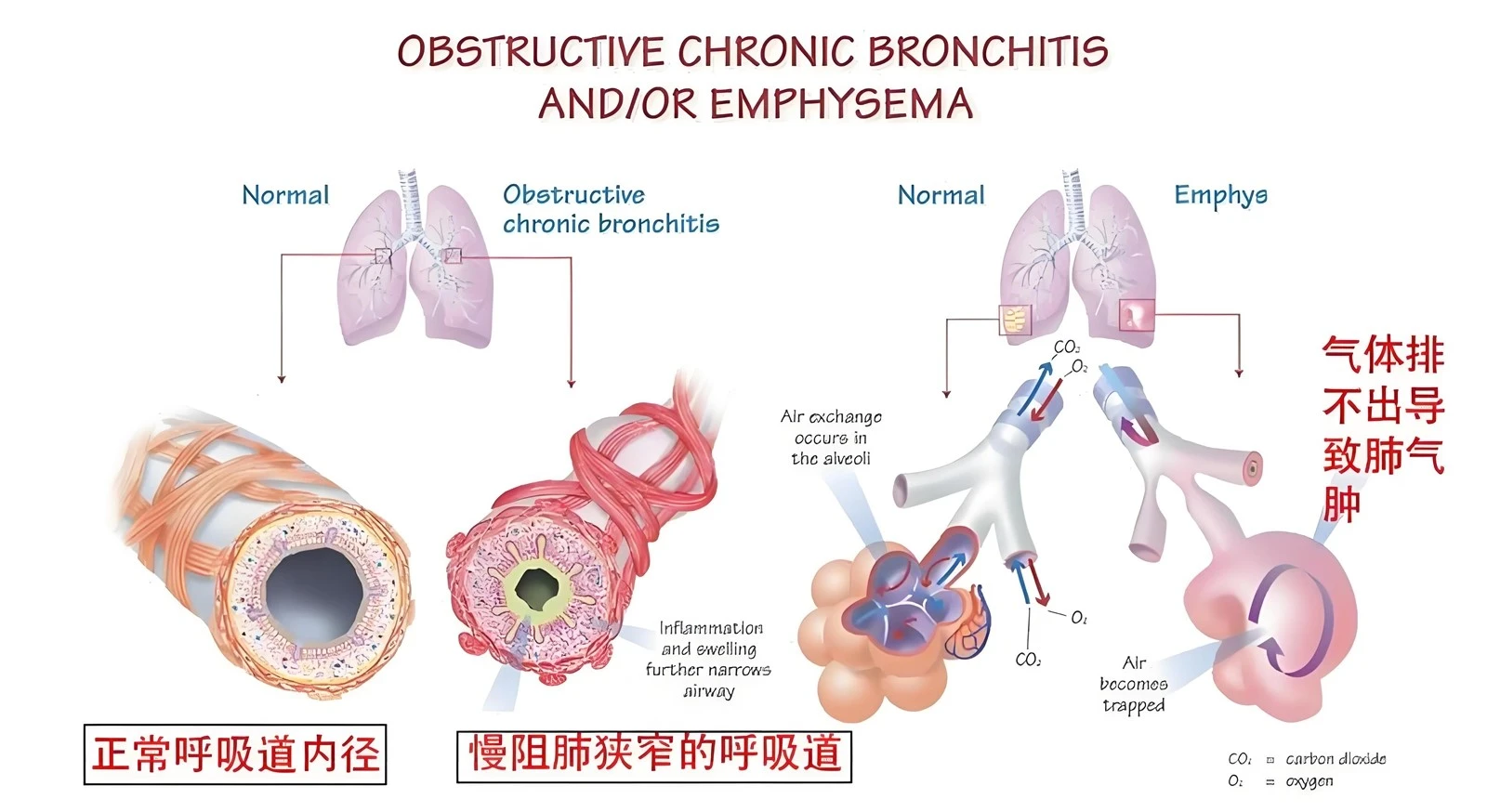 respiratory health